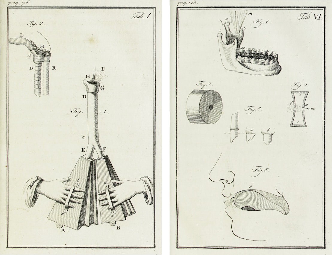 wolfgang_von_kempelens_the_mechanism_of_speech_1791.jpg